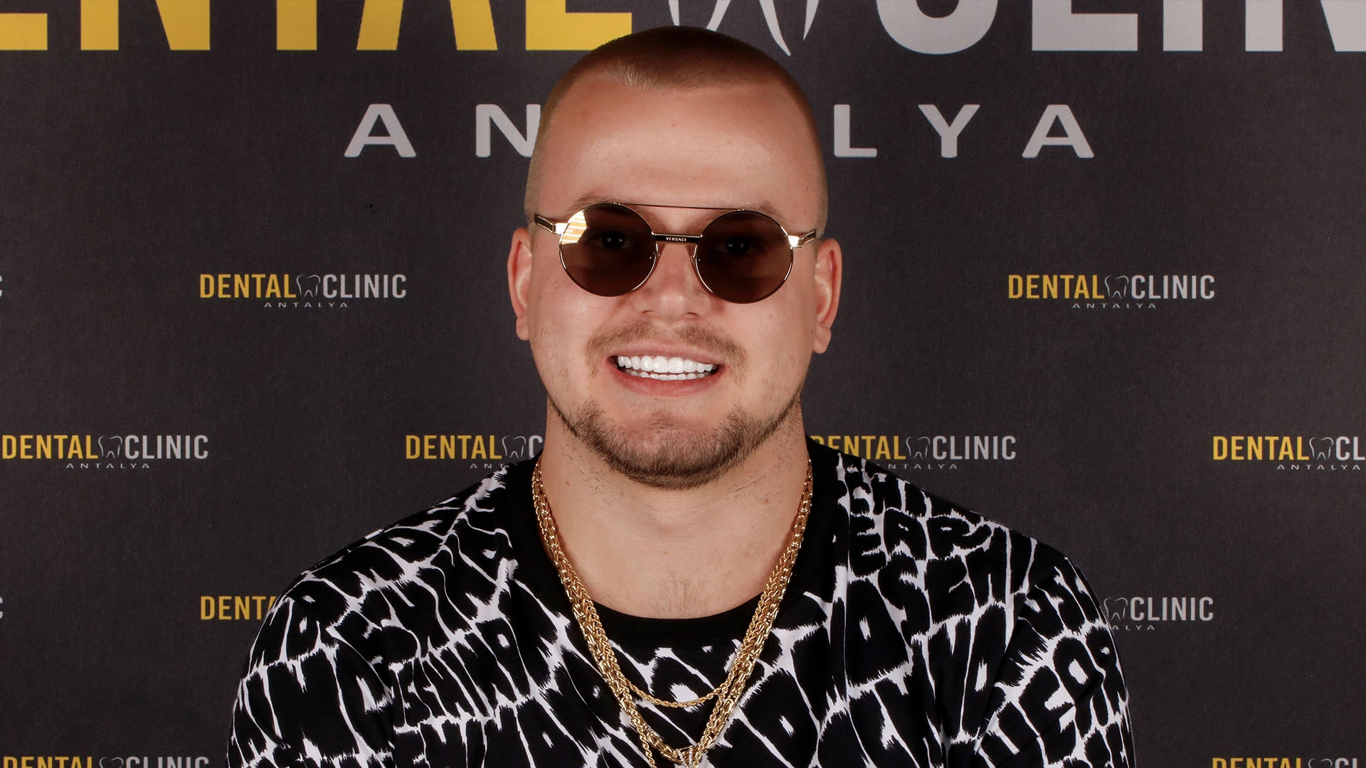 Vorteile eines Hollywood-Lächelns